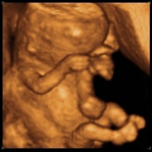eightweeksafterconception3