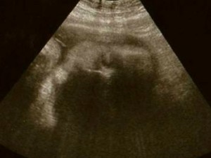 ultrasound1